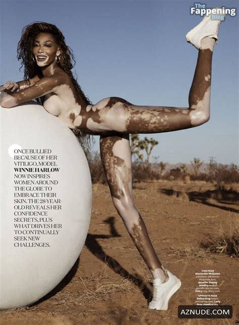winnie harlow s sexy photoshoot for women s health magazine aznude