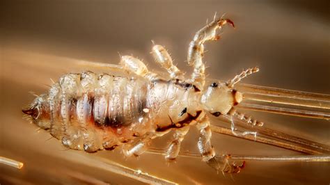 Lice Advice How To Kill The Pesky Irritating Bugs