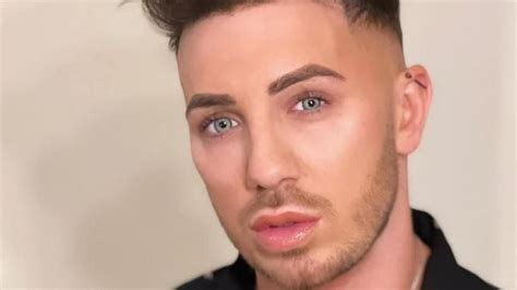 Britains Vainest Man Ditches Cosmetic Surgery After Spending £