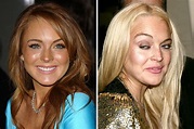 20 Shocking Photos Of Celebrities Before And After Drugs Ruined Their ...