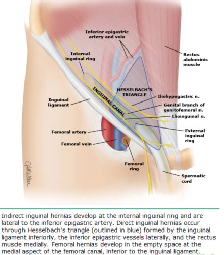 Hernias And The Inguinal Canal Flashcards Quizlet My XXX Hot Girl