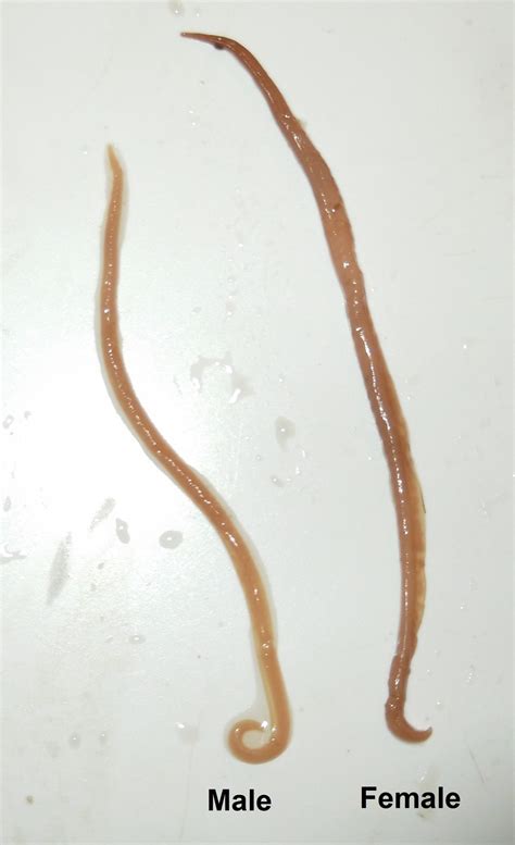 Ascaris Lumbricoides Large Roundworm Adult Parasitology
