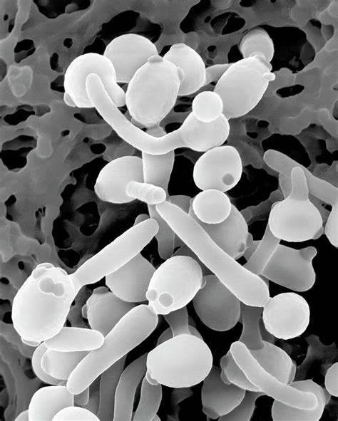 Candida Albicans Photograph By Dennis Kunkel Microscopyscience Photo