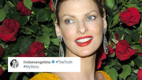 Linda Evangelista Claims Fat Freezing Left Her Brutally Disfigured