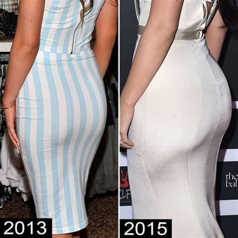 Kylie Jenner Before And After Plastic Surgery Photos Reveal Drastic Changes In Just A Few Years