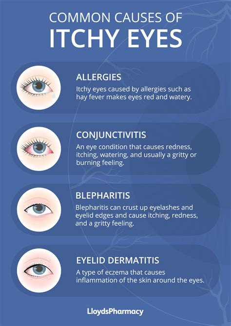 Itchy Eyes Causes And Treatment Lloydspharmacy