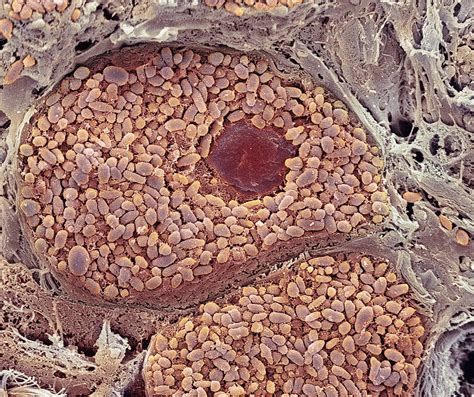 Choroid Layer Of The Eye Sem Photograph By Steve Gschmeissner