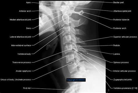 Radiological Anatomy Of The Spine Radiology Student Radiology Anatomy