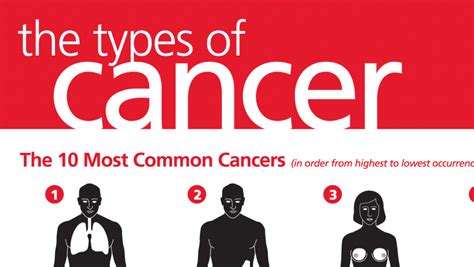 The Most Common Types Of Cancer Primary Medical Care Center For