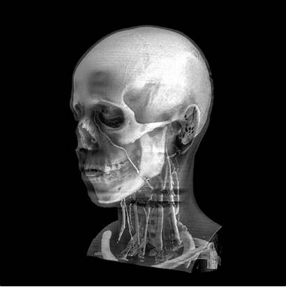Skull Ray Skulls Skeletons Skeleton 3d Pm