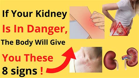 8 Signs Of Kidney Problems If Your Kidney Is In Danger The Body