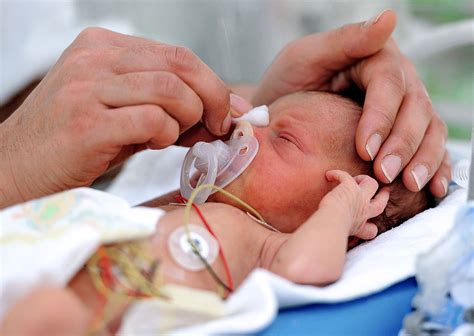 Why are babies born prematurely? Steroid Treatment May Prevent Brain Hemorrhage In Preemie ...