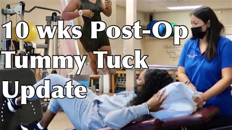 Tummy Tuck Update 10 Weeks Post Op Faja Fitting Taking Physical Therapy To Strengthen My