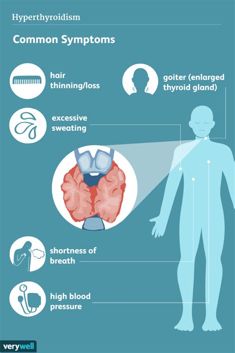 Hyperthyroïdie Signes Symptômes Et Complications