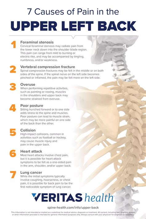 Upper Back Pain Symptoms Spine Health