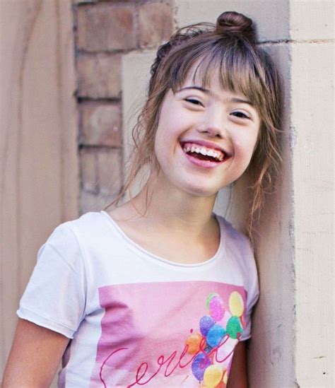 Adults With Downs Syndrome