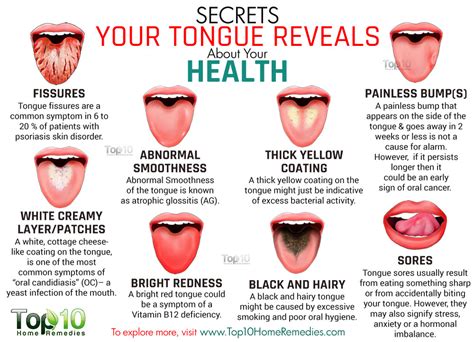 What Your Tongue Says About Your Health How To Instructions