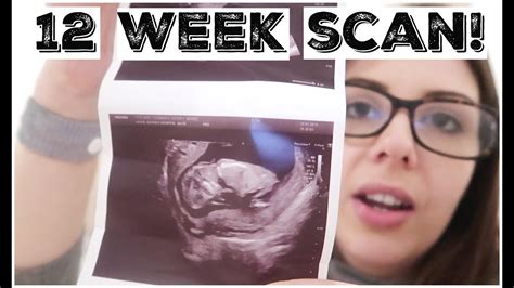 11 12 weeks pregnancy symptoms 12 week dating scan kerry conway youtube