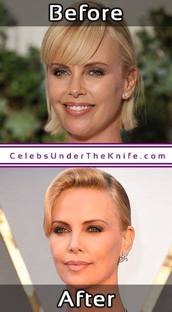 Charlize Theron Plastic Surgery Photos Before After
