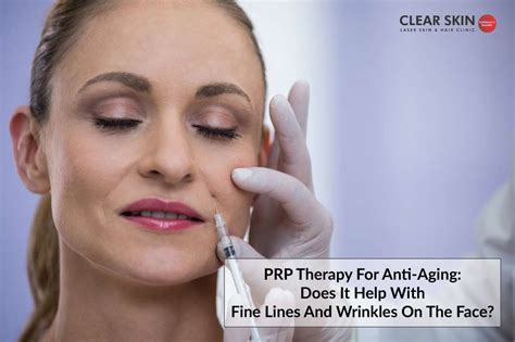 Prp Therapy For Anti Aging Does It Help With Fine Lines And Wrinkles