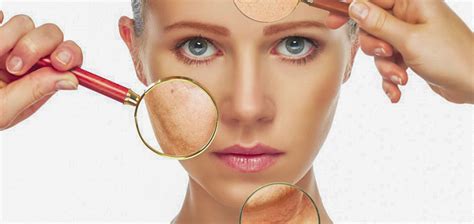 Dry Skin Eczema Atopic Dermatitis Aisha Mirza Md Skincare Science