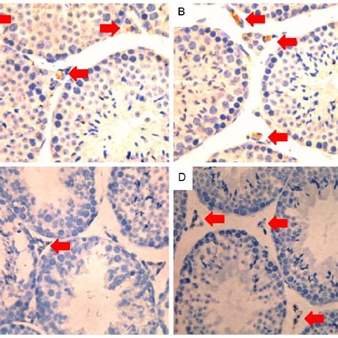Expression of 3β HSD in Leydig cells 3β HSD expression in testicular