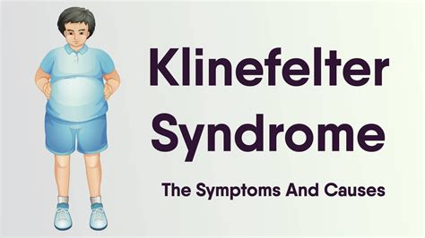 Health Klinefelter Syndrome Help Health