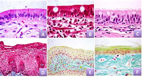 Sos Biologia Celular Y Tisular Tejido Epitelial Epithelial Tissue