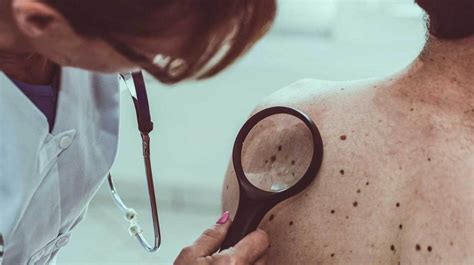 Skin Cancer Artificial Intelligence Vs Dermatologist