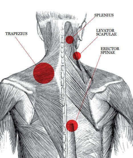 Belayers Neck Neck And Shoulder Pain Neck Pain Shoulder Pain