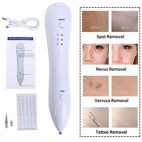 Portable Cautery Warts Removal Facial Machine Free Topical Anesthesia