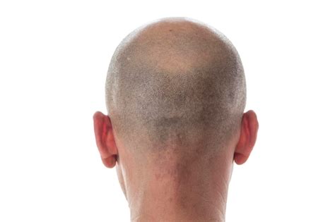 Premium Photo Bald Man Head On The Back