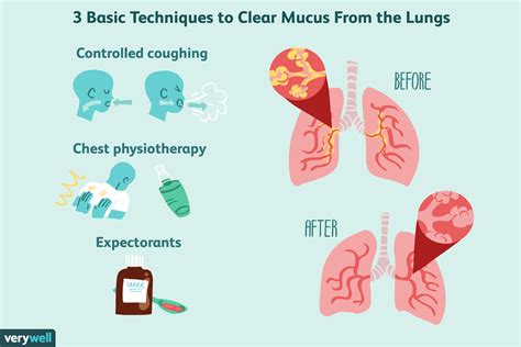 Copd And Coughing Up Mucus