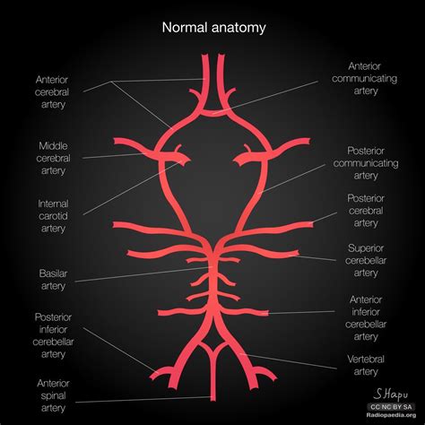 Common Variants Of The Circle Of Willis Illustrations Radiology