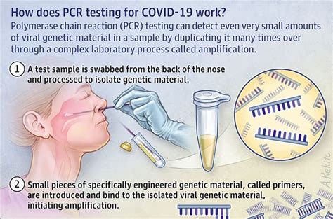 Polymerase chain reaction (pcr) is a method widely used to rapidly make millions to billions of copies of a specific dna sample, allowing scientists to take a very small sample of dna and amplify it to. About PCR Tests, Background, Procedure, Results Timeframe ...