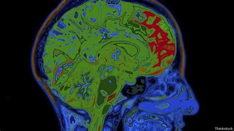 Neurocientíficos Crean Implantes De Cerebro