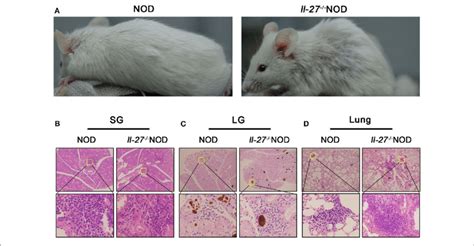 Interleukin 27 Gene Deficiency Aggravated Ss In Nod Mice A The