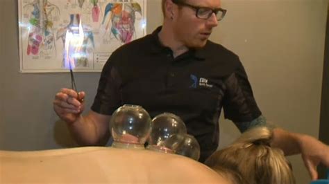 Cupping Therapy Used By Some Olympic Athletes Ctv News