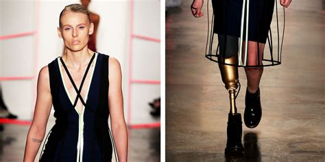 28 Year Old Model Who Lost Her Leg From Using Tampons Walked At New