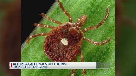 Tick Bites Lead To Red Meat Allergy Youtube