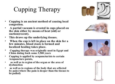 How To Do Cupping Therapy For Mental Health