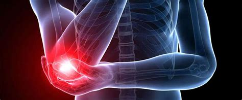 What Are The 5 Most Common Elbow Injuries Bioxcellerator