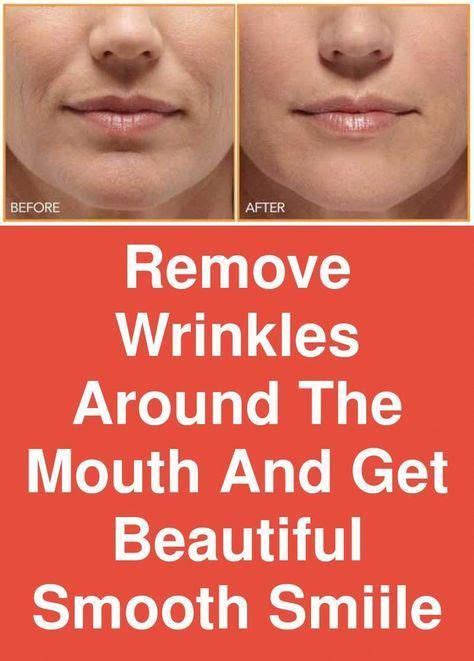 Remove Wrinkles Around The Mouth And Get Beautiful Smooth Smiile The