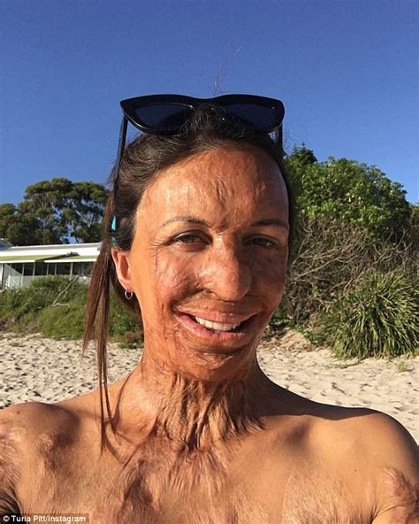 Turia Pitt Jokes She S At Nudist Beach In Instagram Selfie