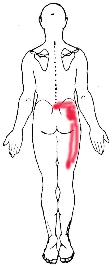 Pain in and around your hip and groin. Muscles In Lower Back And Hip / Image result for hip ...