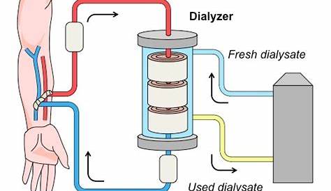 dialysis machine labelled diagram