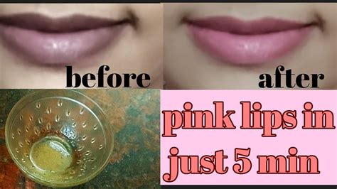How To Lighten Dark Lips Naturallydiy Lip Scrubsoft Pink Lips In Just