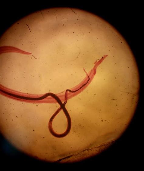 Difference Between Ectoparasite And Endoparasite Definition Features Examples Similarities