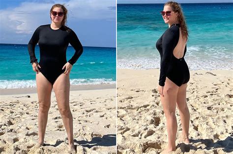 Amy Schumer Shows Off Weight Loss After Liposuction
