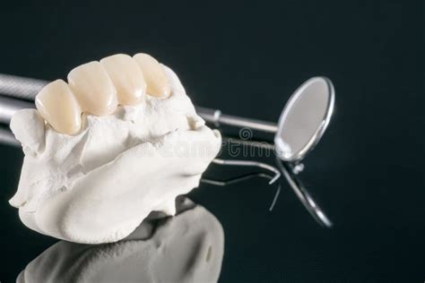 Prosthodontics Or Prosthetic Stock Image Image Of Bracket